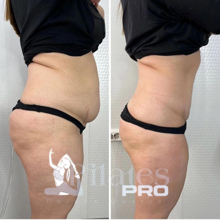 Pilates Pro testemunho1
