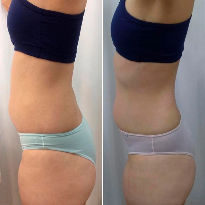 Pilates Pro testemunho10