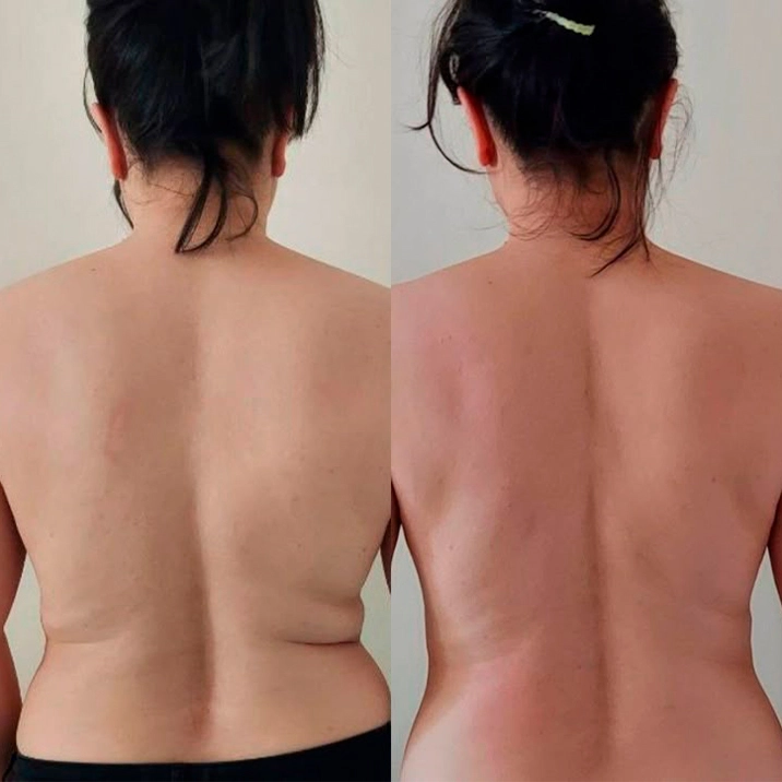 Pilates Pro testemunho7